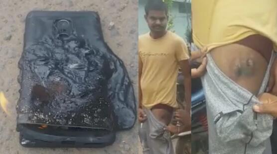 红米Note 4手机裤兜中爆炸 导致印度用户大腿受伤